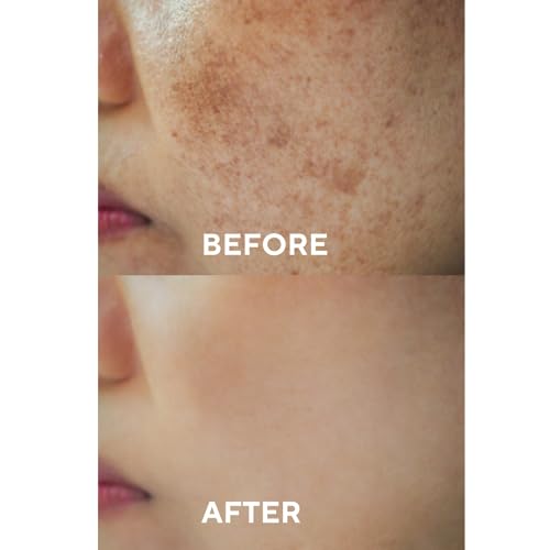 The Ceel Yüz bakım serumu, koyu lekelere karşı, pigment lekelerine karşı, hiyalüronik asitli serum, niasinamid, alfa arbutin, pigment lekesi giderici, yüz 30 ml