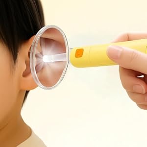 Ear Cleaner with Light & 2X Magnifier – Ear Wax Removal Tool with Soft Silicone & Firm Tips, Detachable Spoon & Tweezers, Portable Storage Case for Home (Amber Yellow)