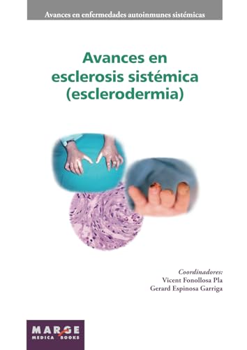 Avances en esclerosis sistémica (esclerodermia) (Spanish Edition)