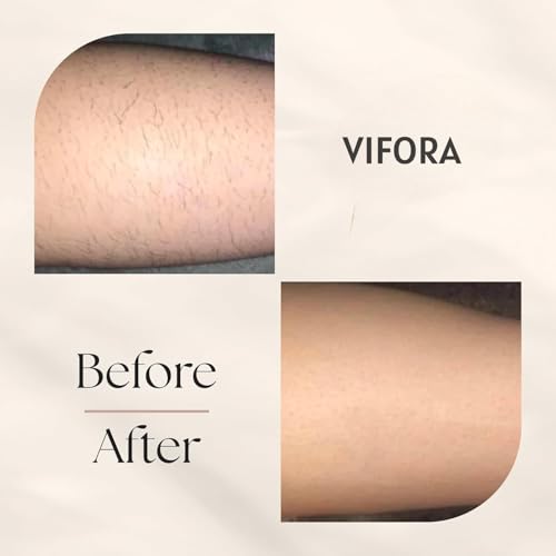 Image of VIFORA IPL Hair Removal Device for Women & Men - Painless Permanent Laser Hair Remover for Face & Body - At-Home Epilator for Bikini, Legs, Arms, Underarms - Fast & Safe Hair Removal