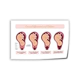 Cervical Dilation Female Human BodyKnowledge Poster Cervical Effacement And Dilation Poster (3) Canvas Art Wall Poster Printing Office Bedroom Aesthetic Poster Living Room 24x16inch(60x40cm) Unframe-s