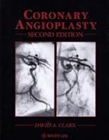 Coronary angioplasty 047156074X Book Cover