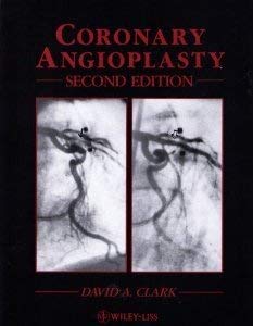 Coronary Angioplasty 047156074X Book Cover