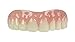 Professional Cosmetic Upper - New from Instant Smile! Hand crafted detail, custom fit at home! Works Best in Medium to Large Sized Mouths.