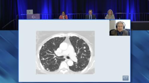 Endometrial Cancer &mdash; Microlearning Activity 1: Proceedings from an Independent Satellite Symposium during the SGO Annual Meeting on Women's Cancer