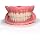 Medium/Large Easy Denture Set