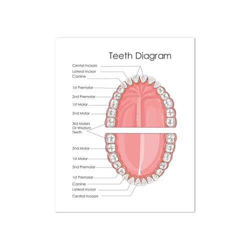 Implante de dientes arte corona Dental impresión dentista regalo anatomía de los dientes médico cuadro sobre lienzo for pared cuadro decoración de clínica Dental(DPH3567,A4 21x30 cm No Frame)