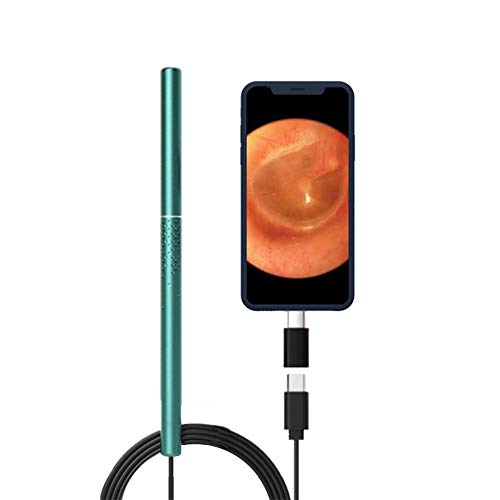 Ohr Endoskop Kit zum Entfernen von Ohrenschmalz HD 3 Millionen Pixel Ohr Otoskop 3-Achsen-Gyroskop-Ohrenschmalzentferner 3.5mm Durchmesser mit