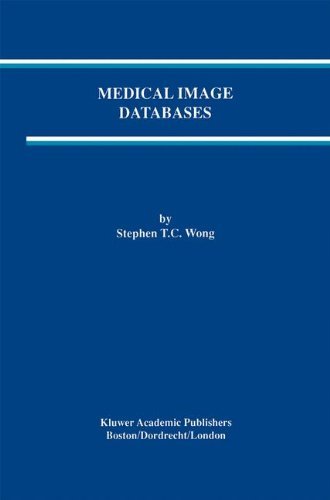 Medical Image Databases (The Springer International Series in Engineering and Computer Science Book 465) (English Edition)