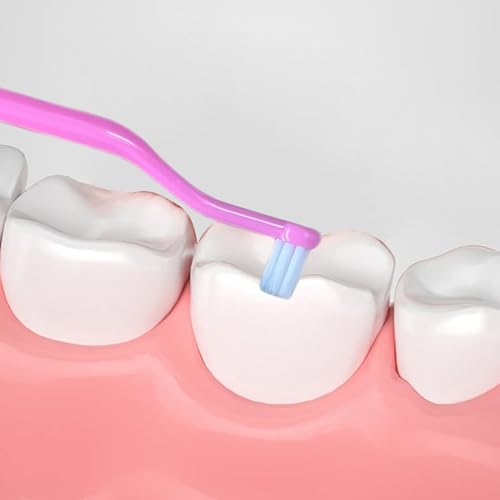 6-teilige Zahnspangen-Zahnbürste 2-in-1-Doppelkopf-Zahnspangenbürste für Interdental- und Weisheitszähne weiche einbüschelige kieferorthopädische Zahnbürste – Bild 7