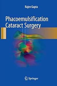 Vedi scheda su Amazon Phacoemulsification Cataract Surgery