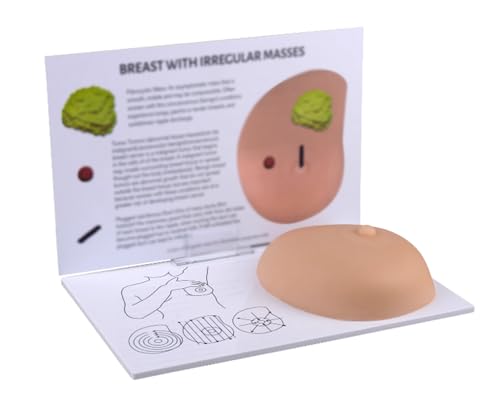 Modèle de cancer de poitrine en silicone pour examen de nodule mammaire