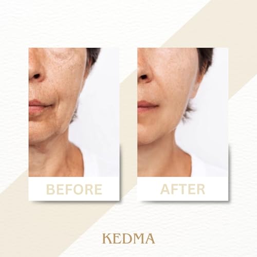 Kedma - Crema Rassodante Royalty Ai Minerali Del Mar Morto E Collagene - Anti-Età E Idratante - 50G - 5