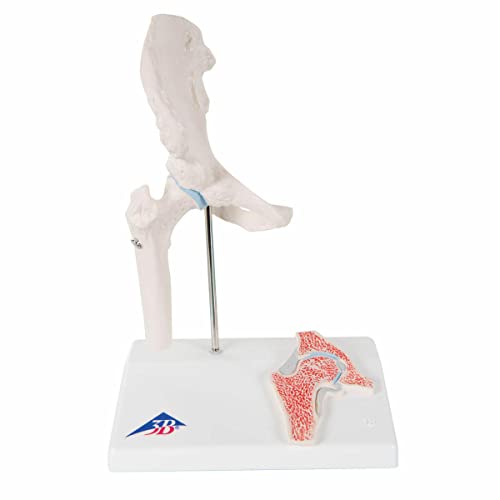 3B Scientific® Mini Articulación de Cadera – Modelo de Cadera Humana a Media Escala con Sección Transversal para Enseñanza de Anatomía + Smart Anatomy App (Garantía de 5 Años)