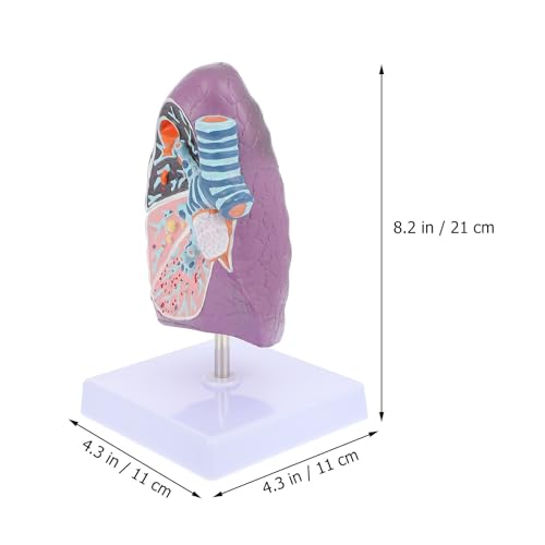 Modèle pulmonaire pathologique réaliste en plastique pour anatomie - 2