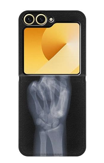 Carcasa Galaxy Z Flip 6 anti-impactos X-Ray Peace Sign funda con bisagra libre de arañazos