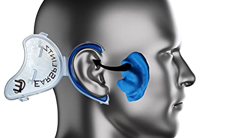 EarSplintz - Cauliflower Ear Treatment