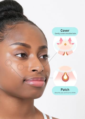 OLIVE YOUNG Care Plus Spot Patch | Hydrokolloid Akne Korean Spot Patch zur Abdeckung von Zits, Pickeln und Hautunreinheiten, für gestörte Haut und Gesicht (Hydrokolloid, 102 Stück (1er Pack)