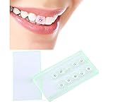 zahn whitening kosten 【Brandneu】100% nagelneue hochwertige Zahnschmucksteine, streng getestet, um die beste Qualität vor dem Versand zu gewährleisten, sicher zu verwenden.