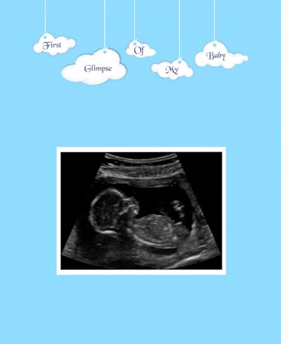 Image of Belly to Baby, A Pregnancy Memory Book. Record Your Pregnancy Photos & Memories. Pregnancy Keepsake, Pregnancy Journal, Pregnancy Scrapbook, Pregnancy Photo Album, Modern Pregnancy Gift.(English)