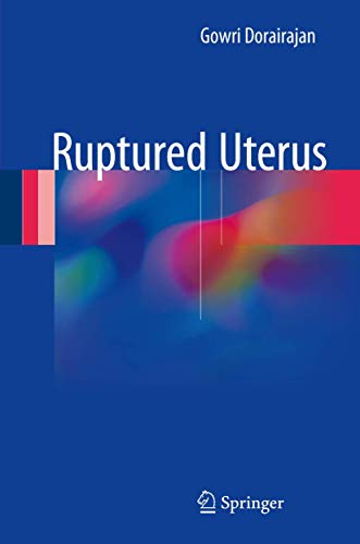 Ruptured Uterus view 2