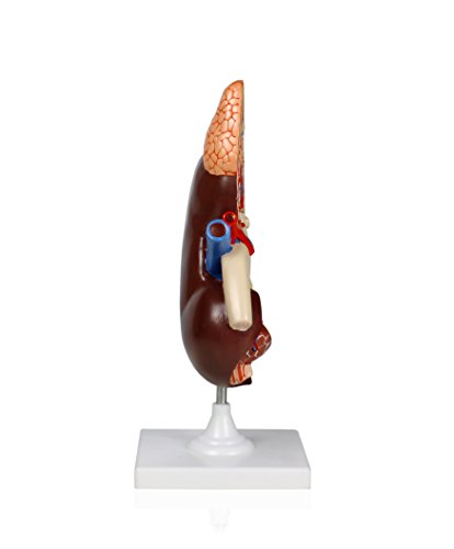 Image of VAU458 3X Kidney Model