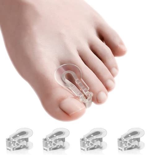 Find The Best Toe Separator For Pedicure Reviews & Comparison Katynel