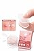 Bye Bye Acne – Hydrocolloid Acne Patches (4-Pack | 288 Patches Total)