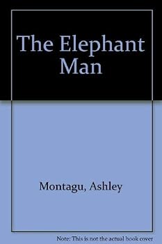 The Elephant Man : A Study in Human Dignity