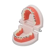 Kieferorthopädisches Zahnmodell, Typodonten Kieferorthopädisches Demonstrationsmodell mit Metalldrähten und Bracket Lehr-, Lern-, Interpretationsmodell für Erwachsene und Kinder