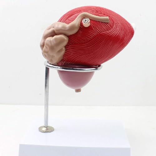Modelo de anatomía de la próstata: vejiga humana y urogenital, tamaño real, vejiga extraíble para fines educativos