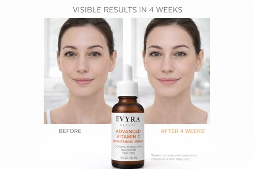 Evyra Beauty Advanced Vitamin C Brightening Serum – 3% Ethyl Ascorbic Acid, 4% Niacinamide & Kojic Acid – Dark Spot Correcting Serum with Hyaluronic Acid, Ferulic Acid & Vitamin E – Hydrating Glow