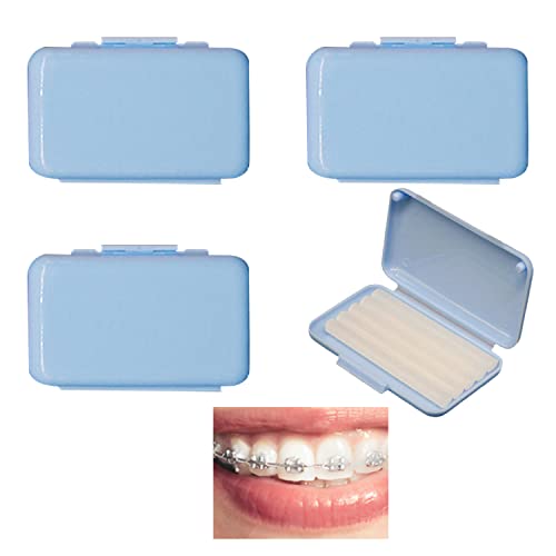 SSKHE 4 Boîtes de Cire Protectrice Orthodontique Menthe, Cire pour Bretelles, Bretelles, Cire Protectrice, Protection des Gencives, Protéger l'émail des Dents (200 Secondaire) Cover