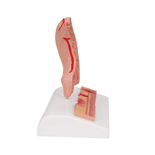 Image of 3B Scientific K17 Stomach w / Ulcers - 3B Smart Anatomy