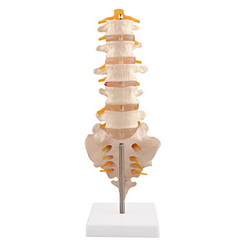 Ultrassist Human Spine Model with 5 Lumbar Vertebrae, Herniation Discs, Lumbar Nerves and Spinal Cord for Medical Teaching