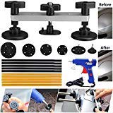 GLISTON Pops-a-dent Bridge Dent Puller Kit with 10pcs Glue Sticks Hot Melt Glue Gun