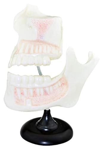 Modèle de dentition décidueuse AMITD pour surmonter la peur du dentiste - 2