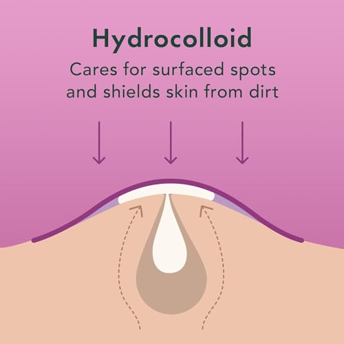 Rael Overnight Hydrocolloid Acne Patches - Extra Adhesion, Vegan & Cruelty-Free, 104 Count (3 Sizes)