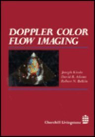Hardcover Doppler Color Flow Imaging Book