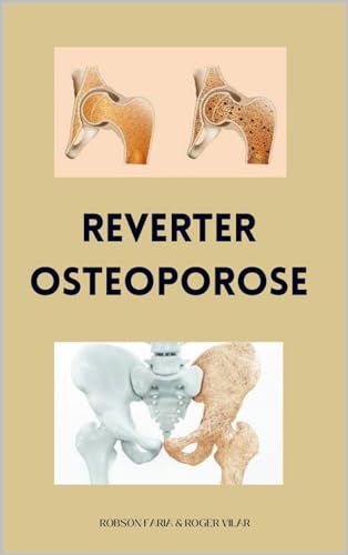 Reverter Osteoporose Naturalmente (Método Natural Que Ajuda No Fortalecimento Ósseo e Na Reversão Da Degeneração) (Portuguese Edition)