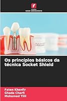 Os princípios básicos da técnica Socket Shield 620928020X Book Cover