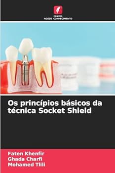 Os princípios básicos da técnica Socket Shield