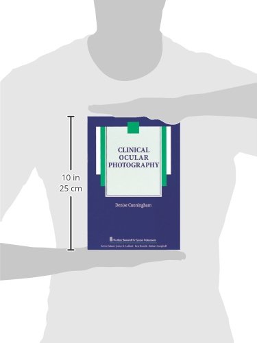 Clinical Ocular Photography (The Basic Bookshelf For Eyecare Professionals) #TOP1