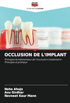 Paperback Occlusion de l'Implant [French] Book