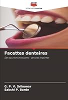 Facettes dentaires (French Edition) 6208995922 Book Cover