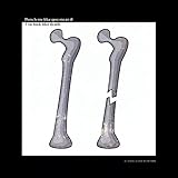 Running Over Rooftops