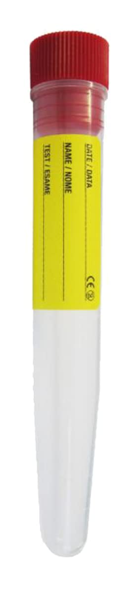 Provette Sterili per Analisi Urine 12ML con Etichetta, Fiale Graduate con Tappo a Pressione, KIT 2 PZ