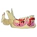 Dental Mandibular Decomposition Teeth Model Oral Caries and Root Cyst Demonstration Anatomical Model for Dentists Dental Academy Students Tool Teaching Education