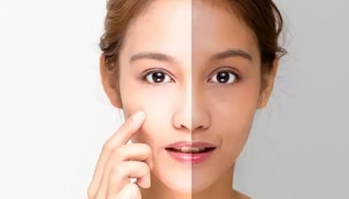 Skin Brightening Treatment Services