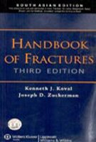 Paperback Handbook Of Fractures Book